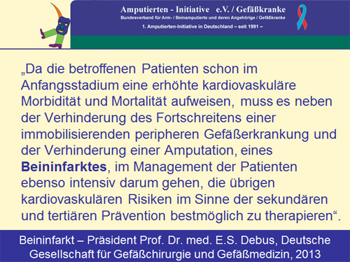 Zum Beininfarkt: Der Präsident der Deutschen Gesellschaft für Gefäßchirurgie und Gefäßmedizin, Professor Dr. med. E.S. Debus, 2013