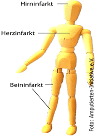 24-jähriges Bestehen der Amputierten-Initiative e.V. / Gefäßkranke am 18.01.2015