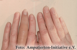 Finger